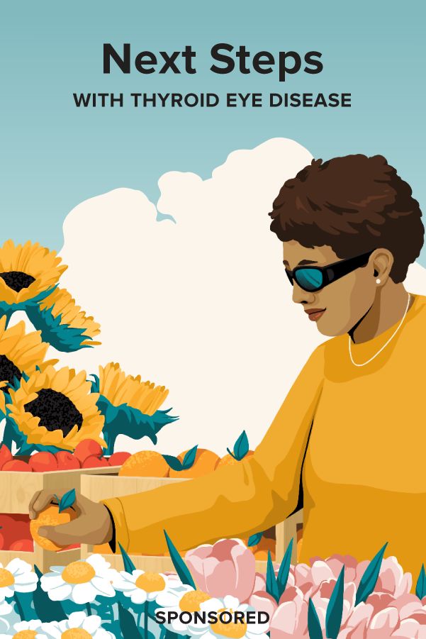 Next Steps with Thyroid Eye Disease