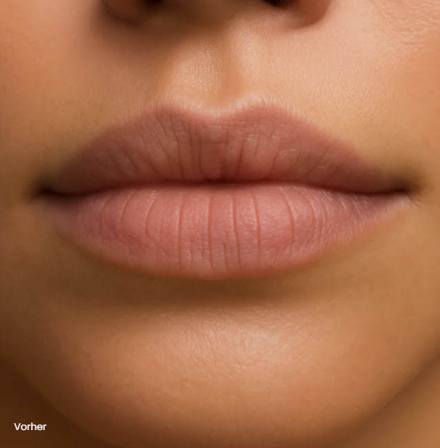 Lippen vorher - natürlicher Zustand
